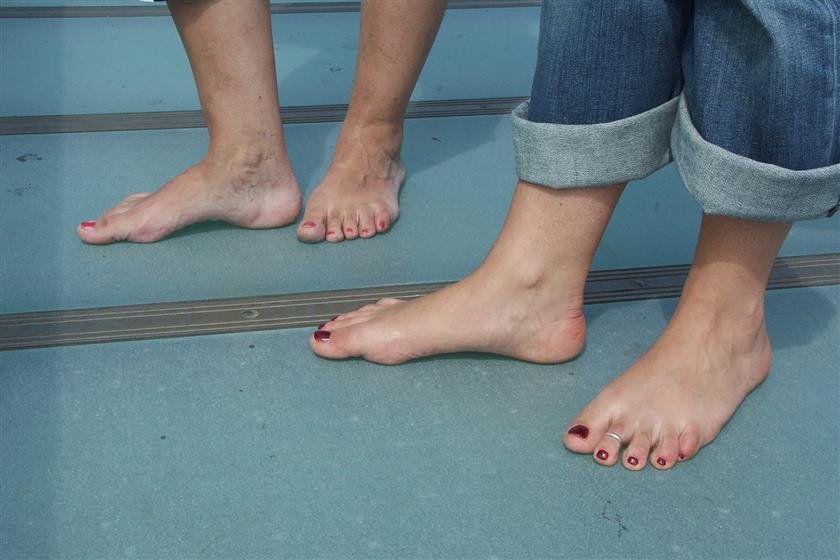 Cover 4 Barefoot Urban Stars: ALYSSA and SOLE 01 31 Photos